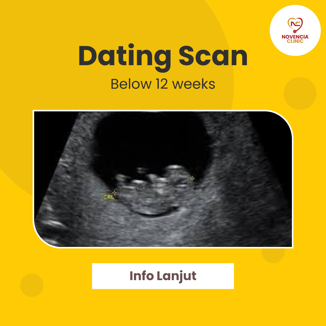 Dating scan nov